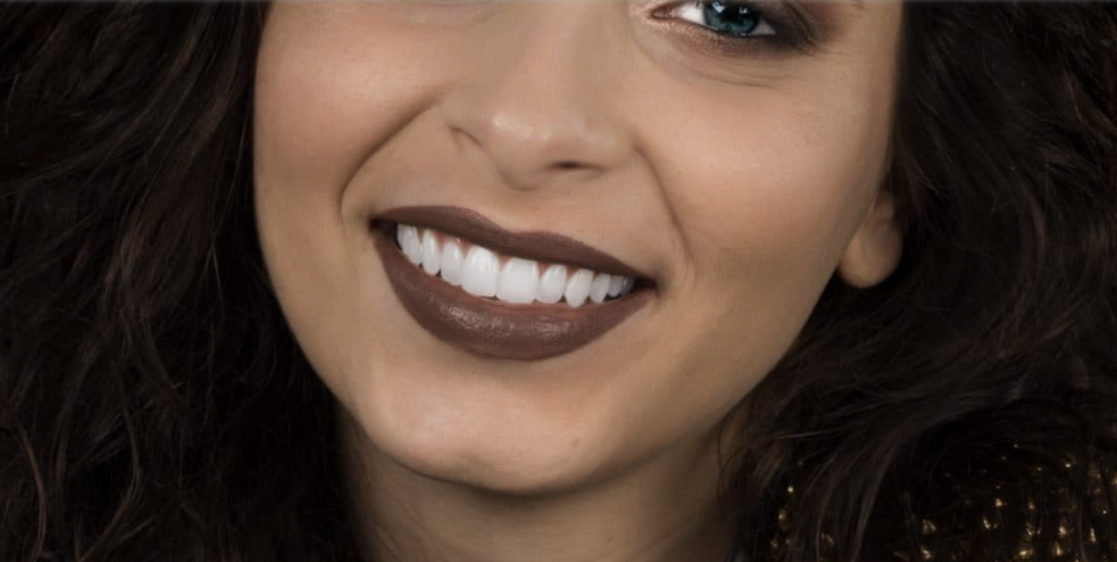 faccette denti